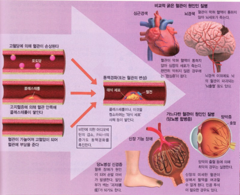 5면-혈관손상2.jpg